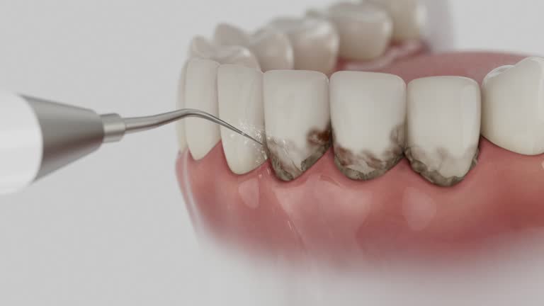 Trusted Emergency Dentist service in Halfway, MD - Dentist Open Now